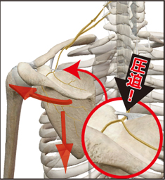 肩の痛みに対する施術の考え方です(施術イメージ・効果には