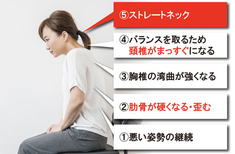 ストレートネックの原因について。首の形そのものより、頭が前に