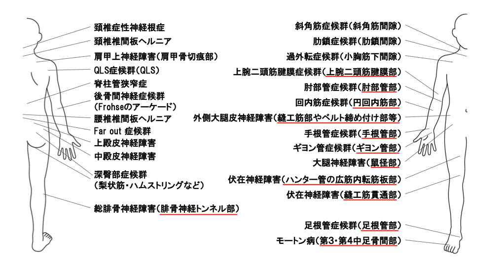 しびれ範囲から疑う病変部位