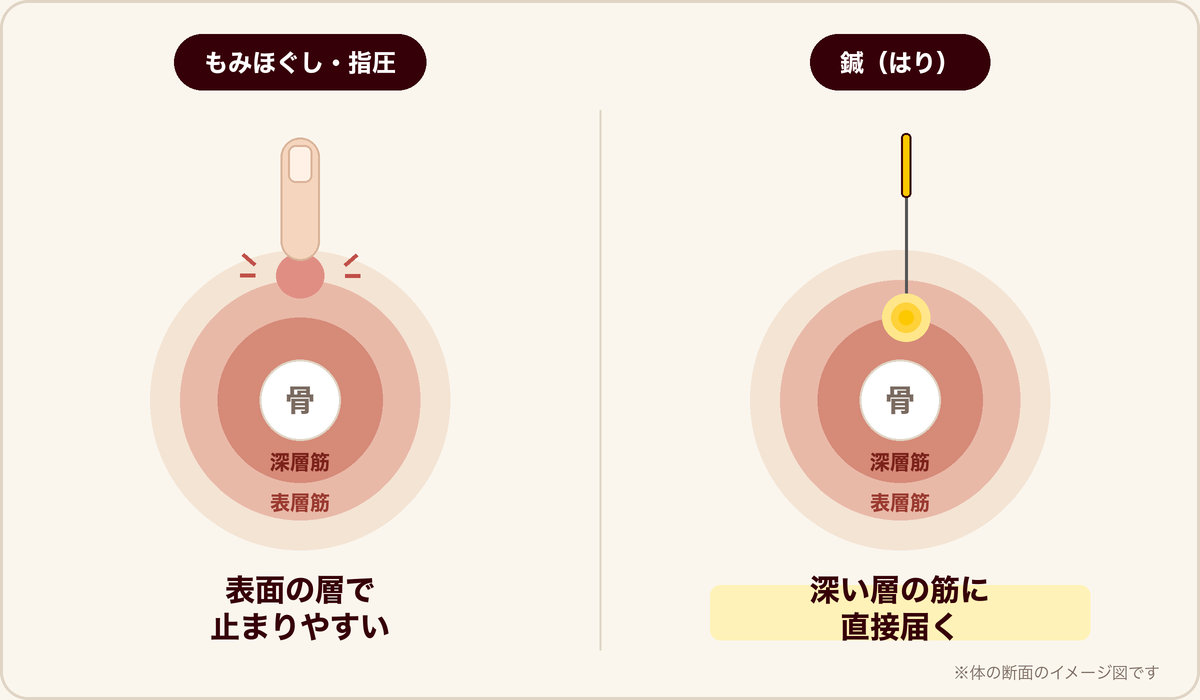 もみほぐしと鍼の届く深さの違い(体の断面のイメージ図)